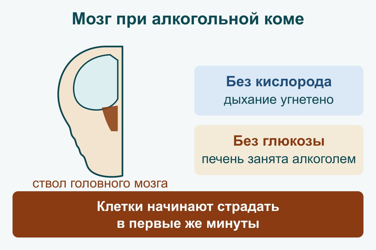 Схема: при коме мозг остаётся без кислорода, потому что дыхание угнетено